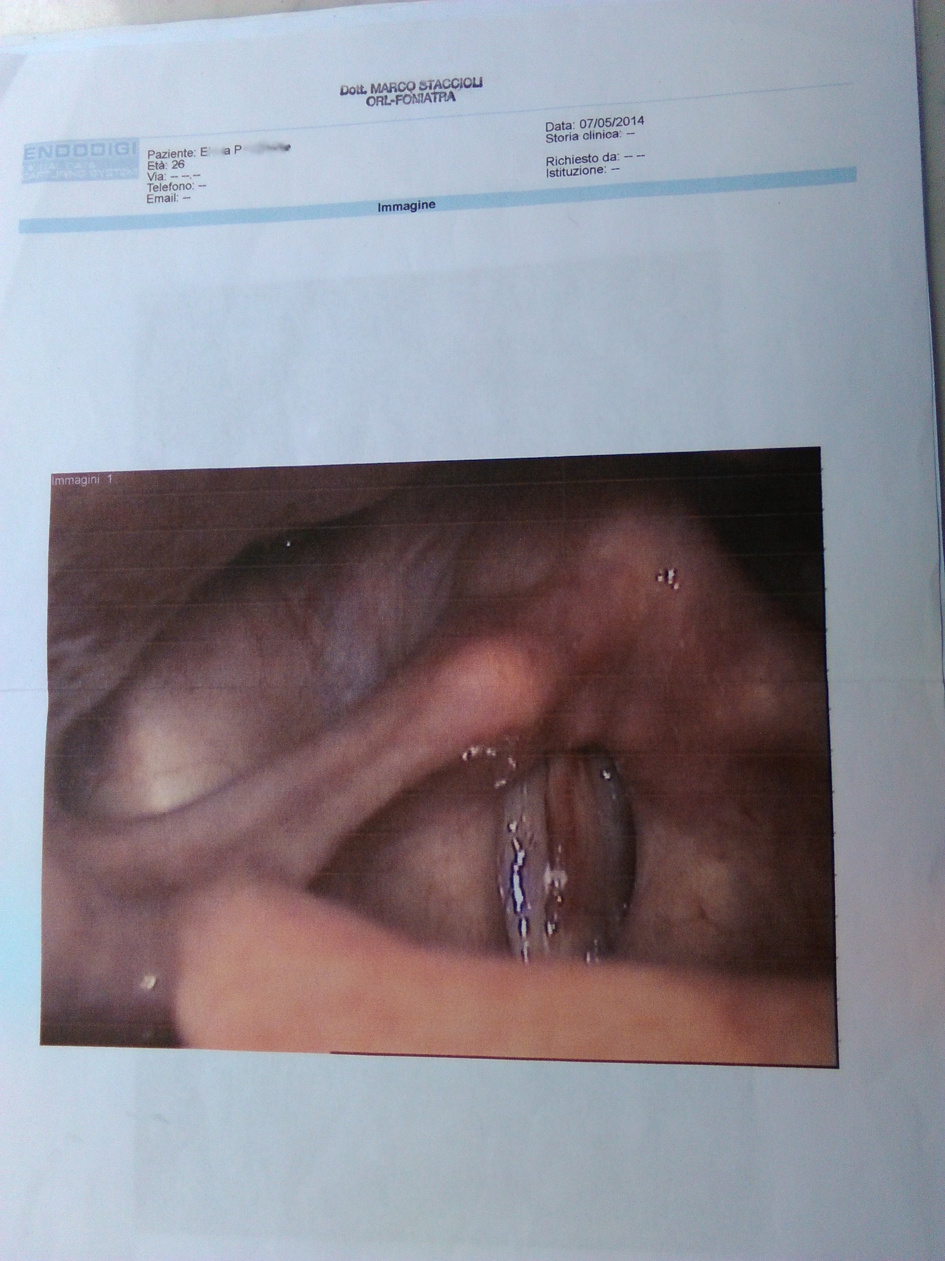 X. Y. vocal folds 07:05:2014