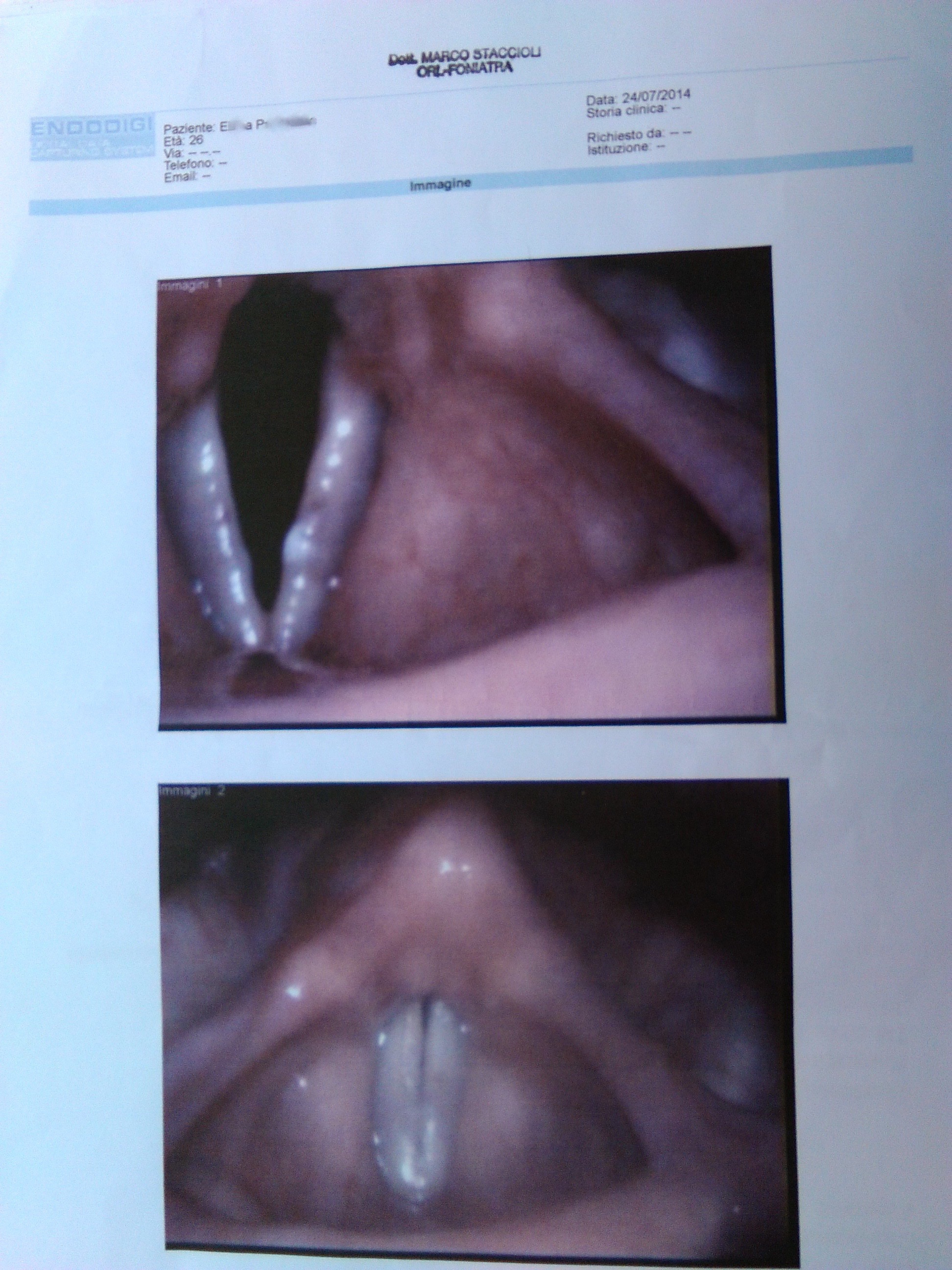 X. Y. vocal folds 24:07:2014